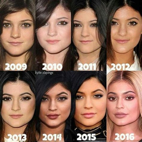 kylie jenner vorher nachher bilder|Kylie Jenner’s Transformation – Her Face & Body。